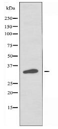 OR4D1 Antibody