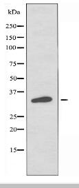 OR5W2 Antibody