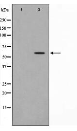 MMP19 Antibody