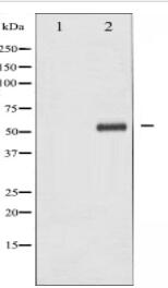 IKK-beta Antibody