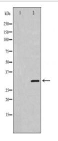 KLK5 Antibody