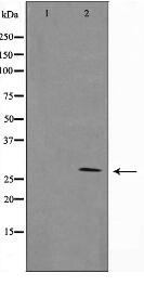 14-3-3 beta/ζ Antibody