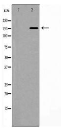 ROCK2 Antibody