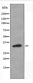 OR11L1 Antibody