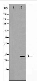 HPRT1 Antibody