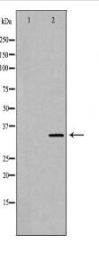 TNFSF11 Antibody