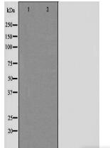 SNCG Antibody