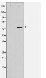 SLC6A15 Antibody