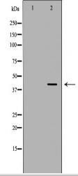 PRKACB Antibody