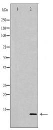 PVALB Antibody