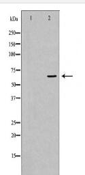 PTH1R Antibody