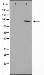 SENP5 Antibody