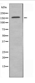 LMTK2 Antibody