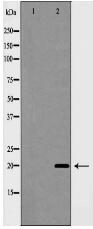 Caveolin 1 Antibody