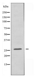 LDLRAD1 Antibody