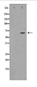 PIAS2 Antibody