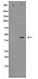 HP Antibody