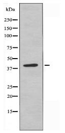 PFDN1 Antibody