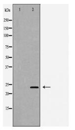 IL24 Antibody
