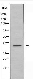 ZADH1 Antibody