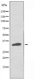 OR2M2 Antibody