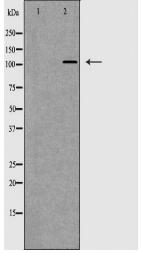 ITGA2B Antibody