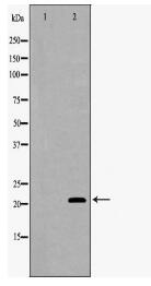 SFTPC Antibody