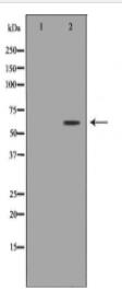 KRT5 Antibody