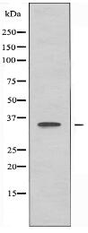 OR4F6 Antibody