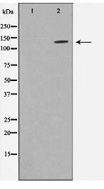 ADNP Antibody