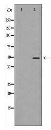 TNFRSF10B Antibody