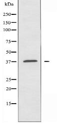 OR5P2 Antibody