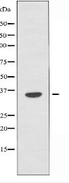 OR4D6 Antibody