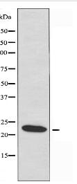 PPP1R14D Antibody