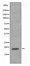 TP53I11 Antibody