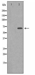 IGF2BP2 Antibody