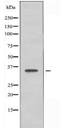 OR5F1 Antibody