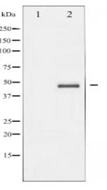 Aurora Kinase Antibody