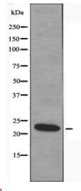 MOBKL2B Antibody