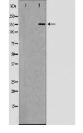 MSH6 Antibody