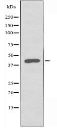 NT Antibody