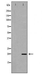 TPT1 Antibody