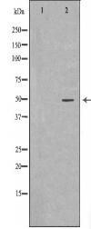 WT1 Antibody