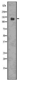 Phospho-PERK (Thr 981) Antibody