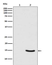 Phospho-alpha Synuclein (S129) Antibody