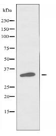 PHCA Antibody
