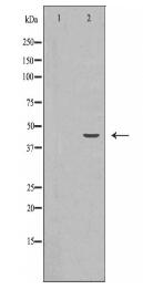 TARDBP Antibody