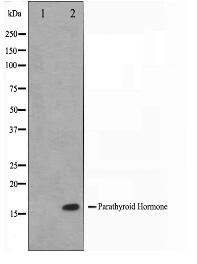 Parathyroid Hormone Antibody