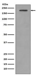 PDGF Receptor beta Antibody