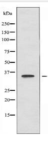 UBR1 Antibody